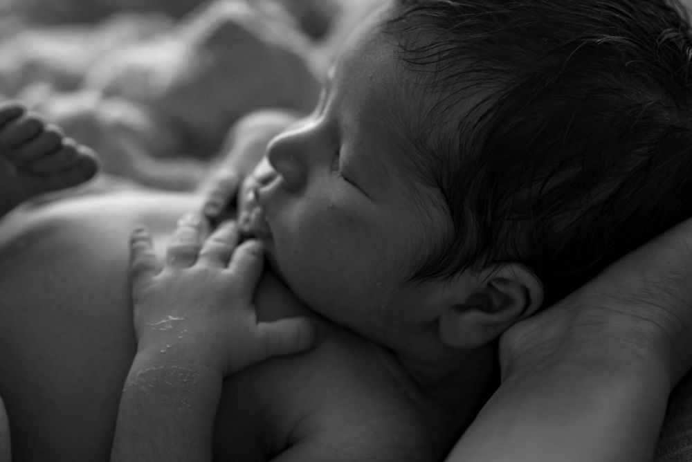 Birth Trauma in Newborns